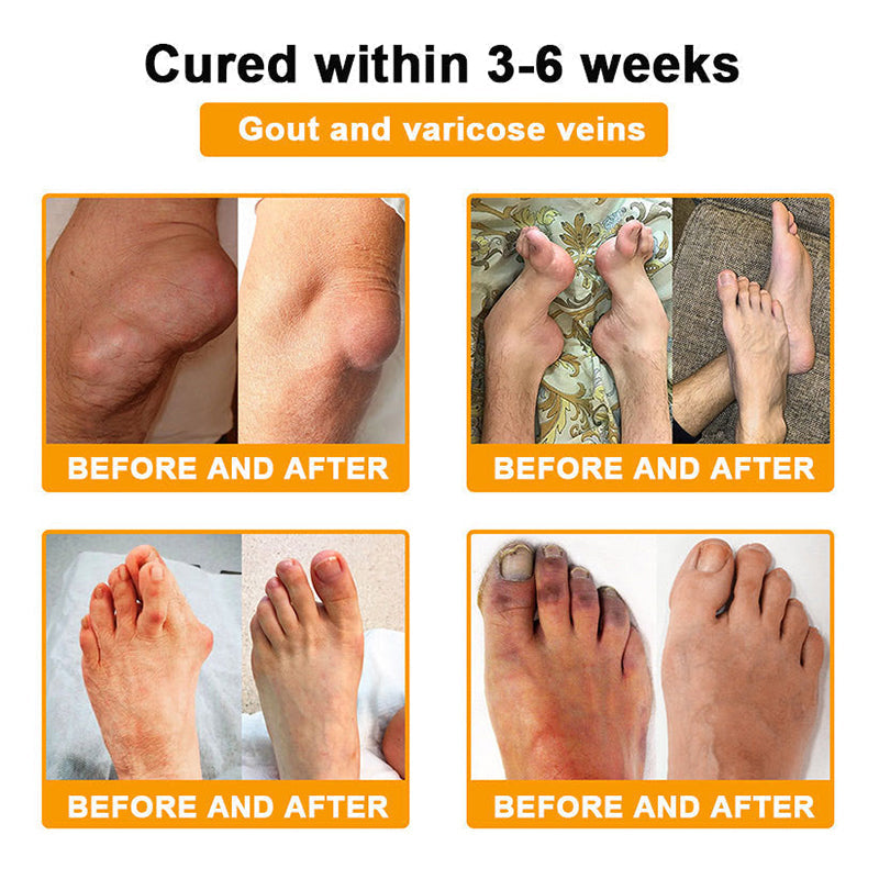 👑Myo Clinic Online Store👑 Myo Clinic BEE VENOM LITHOSPERMUM Pain-Relief Bone Healing Cream 👑(Specially for older adults)