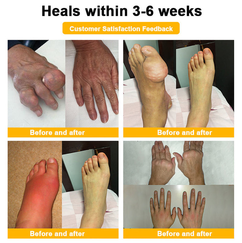 👑Myo Clinic Online Store👑 Myo Clinic BEE VENOM LITHOSPERMUM Pain-Relief Bone Healing Cream 👑(Specially for older adults)
