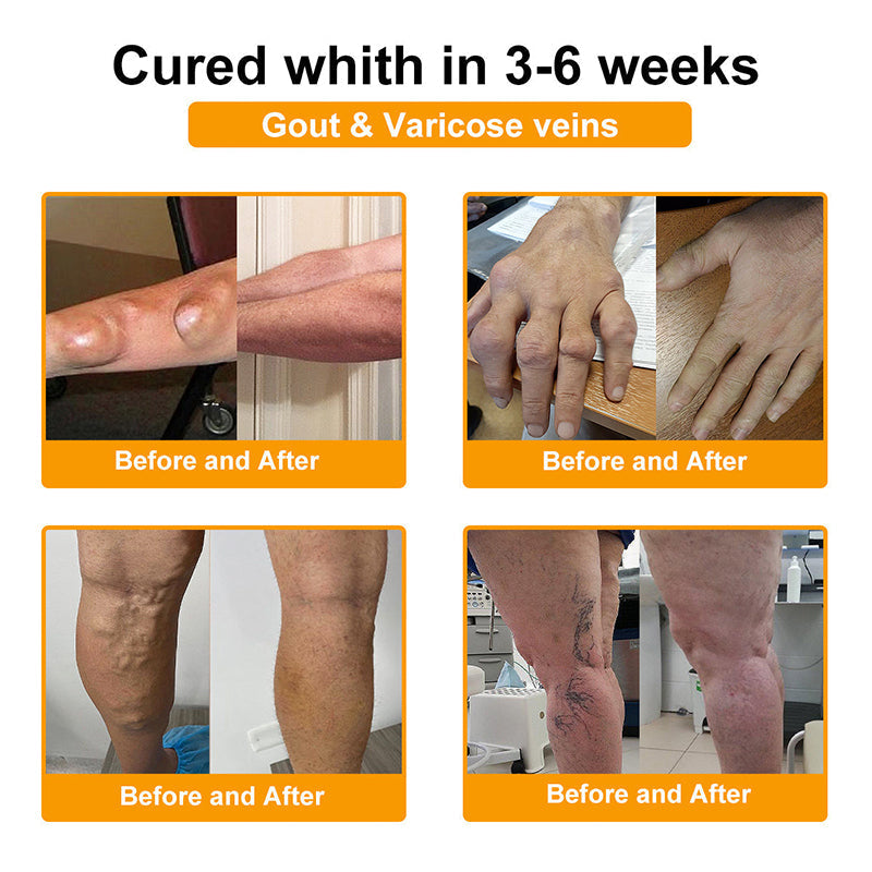 👑Myo Clinic Online Store👑 Myo Clinic BEE VENOM LITHOSPERMUM Pain-Relief Bone Healing Cream 👑(Specially for older adults)