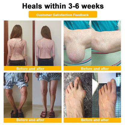 👑Myo Clinic Online Store👑 Myo Clinic BEE VENOM LITHOSPERMUM Pain-Relief Bone Healing Cream 👑(Specially for older adults)