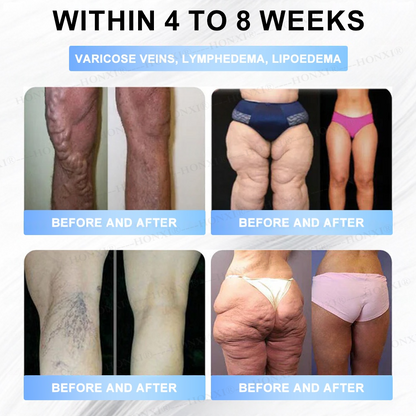 🏥FDA Store | HONXI® Slimming & Health  Nanoparticle Patch with Collagen & Matrixyl 3000 丨Obesity,Cardiovascular Diseas, Diabetes, Sleep Apnea, Joint Problems and More